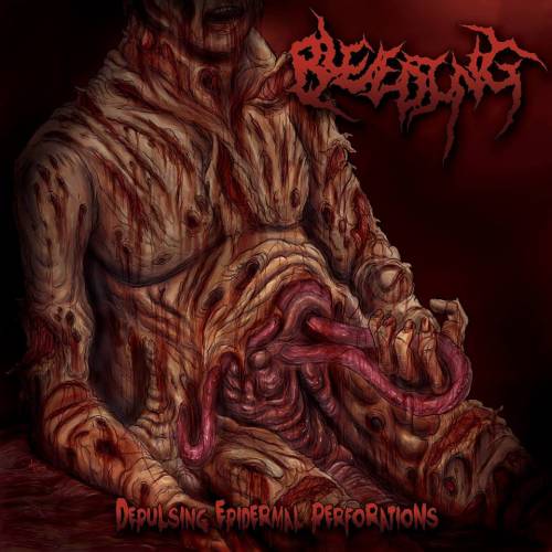 Depulsing Epidermal Perforations